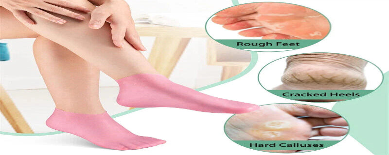 Person wearing pink socks with close-ups of rough feet, cracked heels, and hard calluses.